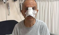 KAYINBİRADERİ, ENİŞTESİNİN BURNUNU KIRDI